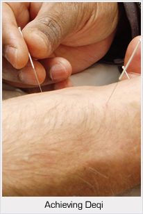 Achieving the sensation of Deqi