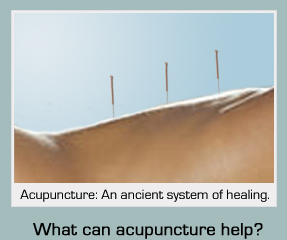 Acupuncture: An ancient system of healing. What can Acupuncture help ?
